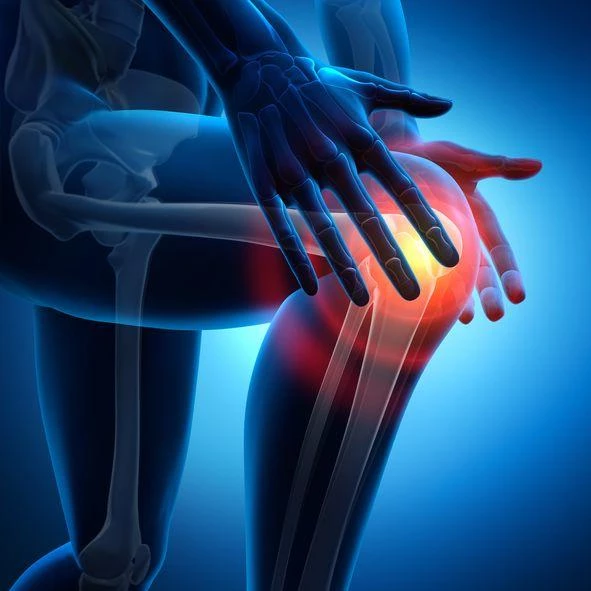 Schemat pękniętej łąkotki